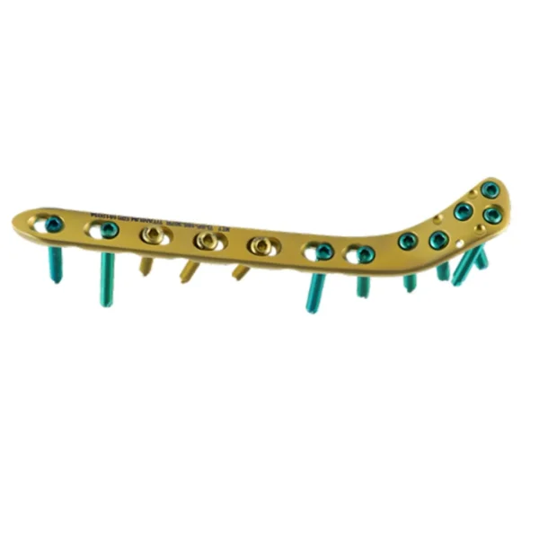 Placa de Bloqueo para Tibia Proximal Lateral 4.5 y 5.0 Titanio