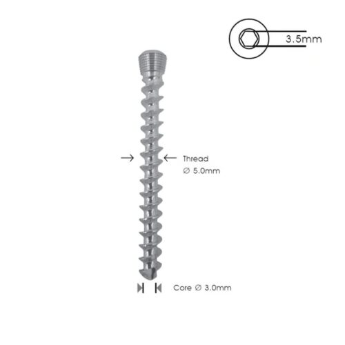 Tornillo de Bloqueo de Esponjosa 5.0 mm TR