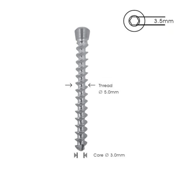 Tornillo de Bloqueo de Esponjosa 5.0 mm TR